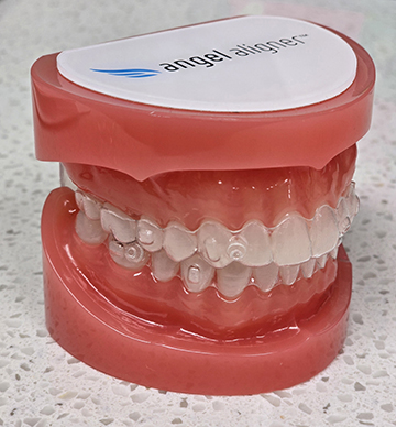 Huntington Beach in Invisalign Teen