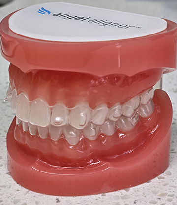 Invisalign Near Me
